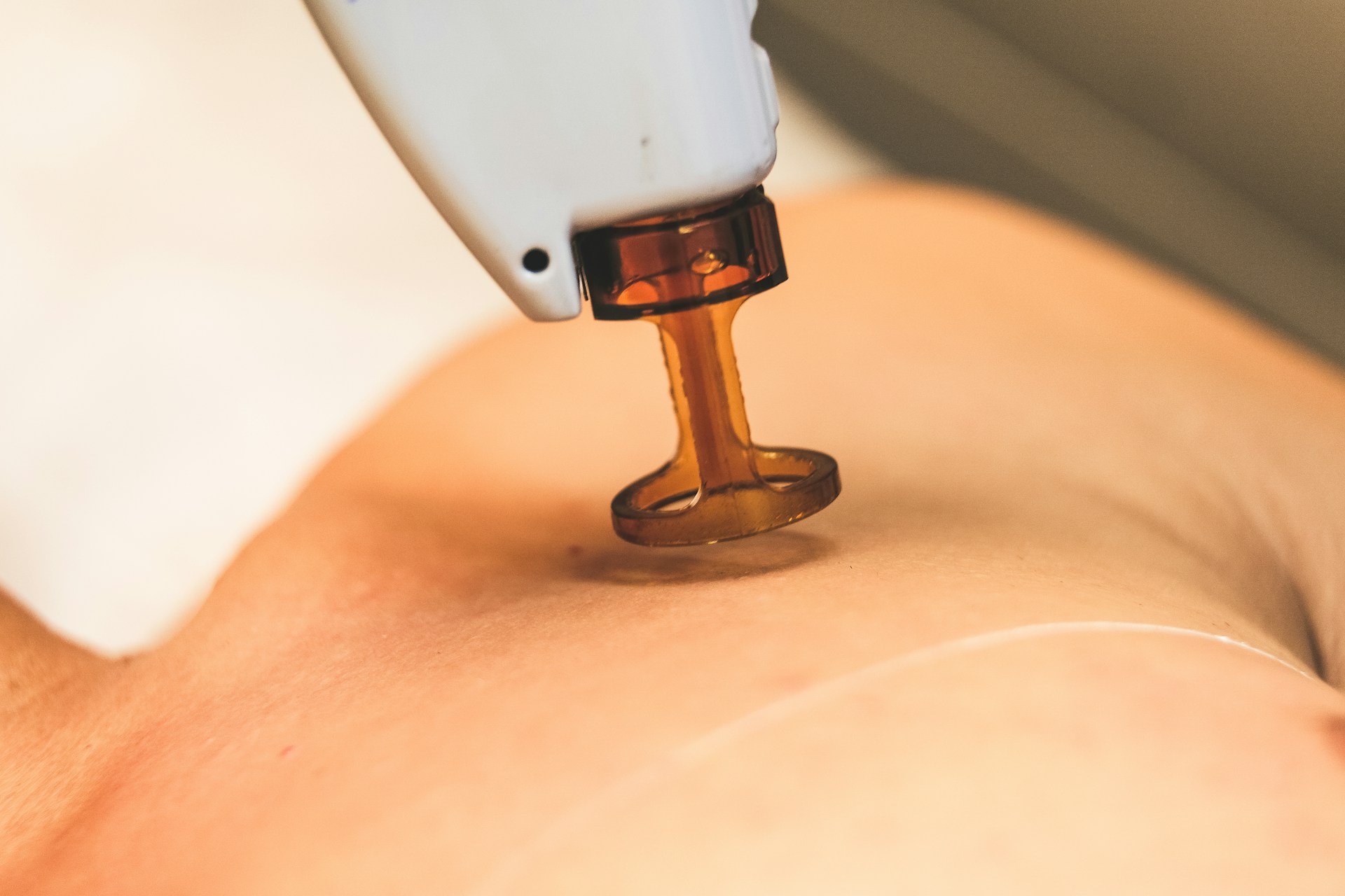Depilacja laserowa Konin